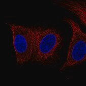 Monoclonal Anti-DES antibody produced in mouse Prestige Antibodies® Powered by Atlas Antibodies, clone CL4502, purified immunoglobulin