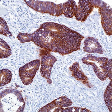 Ep-CAM/Epithelial Specific Antigen (Ber-EP4) Mouse Monoclonal Antibody