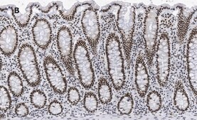 Anti-BRG1 Antibody, clone 1N12, ZooMAb® Rabbit Monoclonal recombinant, expressed in HEK 293 cells