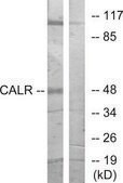 Anti-CALR antibody produced in rabbit affinity isolated antibody