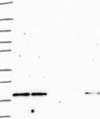 Anti-RHOH antibody produced in rabbit Prestige Antibodies® Powered by Atlas Antibodies, affinity isolated antibody, buffered aqueous glycerol solution