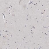 Anti-MATN1 antibody produced in rabbit Prestige Antibodies® Powered by Atlas Antibodies, affinity isolated antibody, buffered aqueous glycerol solution