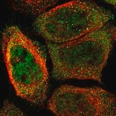 Anti-ORAI3 antibody produced in rabbit Prestige Antibodies® Powered by Atlas Antibodies, affinity isolated antibody, buffered aqueous glycerol solution