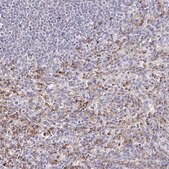 Anti-CYBB antibody produced in rabbit Prestige Antibodies® Powered by Atlas Antibodies, affinity isolated antibody, buffered aqueous glycerol solution