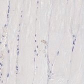 Anti-CLU antibody produced in rabbit Prestige Antibodies® Powered by Atlas Antibodies, affinity isolated antibody, buffered aqueous glycerol solution