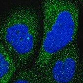 Anti-RAP1GDS1 antibody produced in rabbit affinity isolated antibody, buffered aqueous glycerol solution