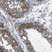 Anti-STIM1 antibody produced in rabbit Prestige Antibodies® Powered by Atlas Antibodies, affinity isolated antibody, buffered aqueous glycerol solution