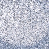 Monoclonal Anti-TYRP1 antibody produced in mouse Prestige Antibodies® Powered by Atlas Antibodies, clone CL4923, purified immunoglobulin, buffered aqueous glycerol solution