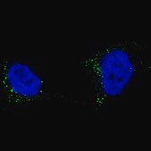 Monoclonal Anti-TYRP1 antibody produced in mouse Prestige Antibodies® Powered by Atlas Antibodies, clone CL4917, purified immunoglobulin, buffered aqueous glycerol solution