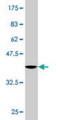 Monoclonal Anti-DCP1A antibody produced in mouse clone 3G4, purified immunoglobulin, buffered aqueous solution