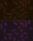 Anti-DCP1A antibody produced in rabbit