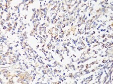 Anti-mTOR antibody produced in rabbit
