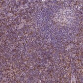 Monoclonal Anti-S100A4 antibody produced in mouse Prestige Antibodies® Powered by Atlas Antibodies, clone CL0237, purified immunoglobulin, buffered aqueous glycerol solution
