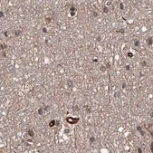 Anti-RPAP3 antibody produced in rabbit Prestige Antibodies® Powered by Atlas Antibodies, affinity isolated antibody, buffered aqueous glycerol solution