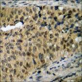 抗-磷酸化-Mst1/2 (pThr183) 兔抗 affinity isolated antibody