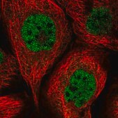 Anti-SORBS2 antibody produced in rabbit Prestige Antibodies® Powered by Atlas Antibodies, affinity isolated antibody, buffered aqueous glycerol solution