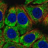 Anti-RPS3 antibody produced in rabbit Prestige Antibodies® Powered by Atlas Antibodies, affinity isolated antibody, buffered aqueous glycerol solution