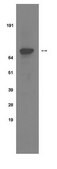 Anti-phospho-Insulin Receptor (Tyr 1322) Antibody, clone 21G12 clone 21g12, Upstate®, from mouse