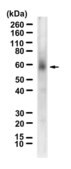Anti-ST2/IL-33R Antibody, clone 1N22 ZooMAb® Rabbit Monoclonal recombinant, expressed in HEK 293 cells
