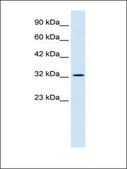 Anti-SMARCA2 antibody produced in rabbit affinity isolated antibody