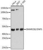 Anti- SMARCB1/SNF5 antibody produced in rabbit