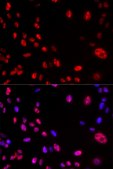 Anti-Phospho-ATM-S1981 antibody produced in rabbit