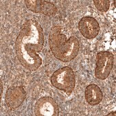 Anti-MICU1 antibody produced in rabbit Prestige Antibodies® Powered by Atlas Antibodies, affinity isolated antibody, buffered aqueous glycerol solution