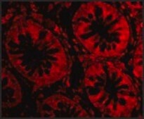 Anti-TEM1 (ab1) antibody produced in rabbit affinity isolated antibody, buffered aqueous solution