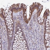 Anti-KCNMA1 antibody produced in rabbit Prestige Antibodies® Powered by Atlas Antibodies, affinity isolated antibody, buffered aqueous glycerol solution
