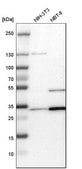 Anti-TPM3 antibody produced in rabbit Prestige Antibodies® Powered by Atlas Antibodies, affinity isolated antibody, buffered aqueous glycerol solution