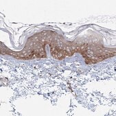 Anti-SH3PXD2A antibody produced in rabbit Prestige Antibodies® Powered by Atlas Antibodies, affinity isolated antibody, buffered aqueous glycerol solution