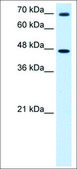 Anti-GABRP antibody produced in rabbit affinity isolated antibody