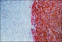 Anti-Fibroblast Growth Factor-Basic (1-24) antibody produced in rabbit fractionated antiserum, lyophilized powder
