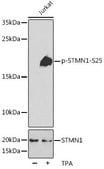 Anti-Phospho-STMN1-S25 antibody produced in rabbit