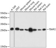 Anti-TIMP2 antibody produced in rabbit