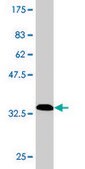 Monoclonal Anti-SMARCB1 antibody produced in mouse clone 3E10, purified immunoglobulin, buffered aqueous solution