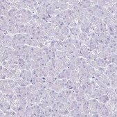 Anti-TIMP1 antibody produced in rabbit Prestige Antibodies® Powered by Atlas Antibodies, affinity isolated antibody, buffered aqueous glycerol solution