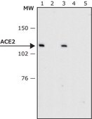 Anti-ACE2 antibody produced in rabbit affinity isolated antibody, buffered aqueous solution