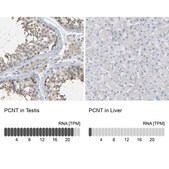 Anti-PCNT antibody produced in rabbit Prestige Antibodies® Powered by Atlas Antibodies, affinity isolated antibody, buffered aqueous glycerol solution, Ab2
