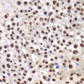Anti- SMARCB1/SNF5 antibody produced in rabbit