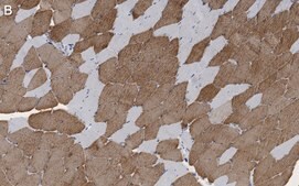 Anti-Myosin Heavy Chain 7 Antibody, clone 1B19, ZooMAb® Rabbit Monoclonal recombinant, expressed in HEK 293 cells