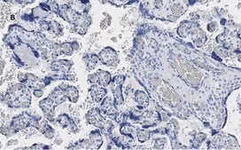 Anti-YAP1 Antibody, clone 4F22, ZooMAb® Rabbit Monoclonal recombinant, expressed in HEK 293 cells