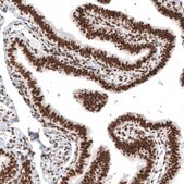 Monoclonal Anti-H2AFY antibody produced in mouse Prestige Antibodies® Powered by Atlas Antibodies, clone CL5245, purified immunoglobulin, buffered aqueous glycerol solution