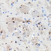 Anti-NMDAR2A antibody produced in rabbit