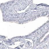 Monoclonal Anti-HMOX1 antibody produced in mouse Prestige Antibodies® Powered by Atlas Antibodies, clone CL11669, purified immunoglobulin, buffered aqueous glycerol solution