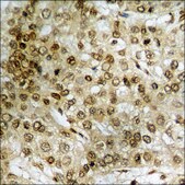 Anti-phospho-STAT3 (pTyr705) antibody produced in rabbit affinity isolated antibody