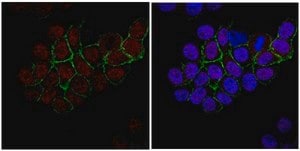 抗 RNF168 抗体 from rabbit, purified by affinity chromatography