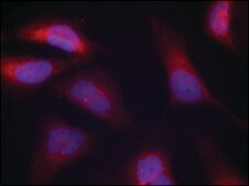 Anti-phospho-EIF2AK2 (pThr446) antibody produced in rabbit affinity isolated antibody