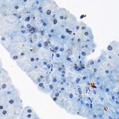 Anti-TARBP2 antibody produced in rabbit