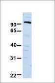 Anti-SUV420H1 antibody produced in rabbit affinity isolated antibody